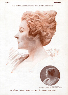 Cecile Sorel 1922 Le Raccommodeur de Porcelaines (Aesthetics) Lifting