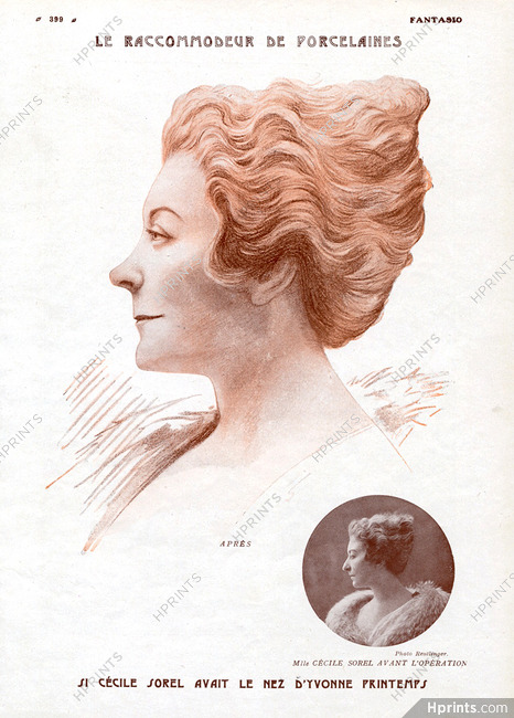 Cecile Sorel 1922 Le Raccommodeur de Porcelaines (Aesthetics) Plastic Surgery